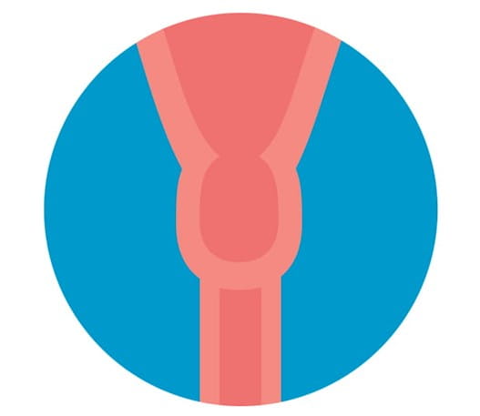 Image du col de l'utérus